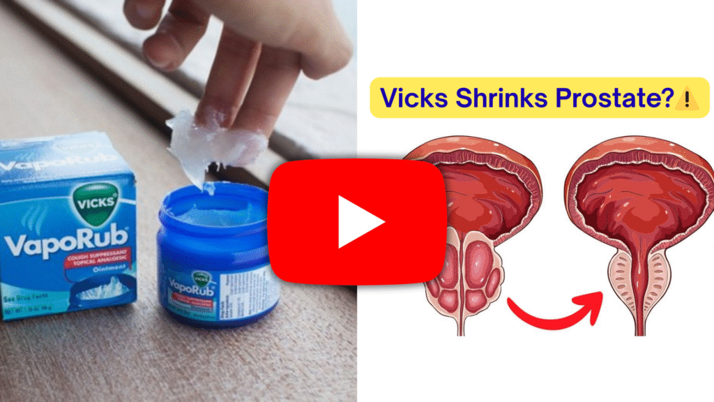 enlarged prostate treatment with vick vaporub